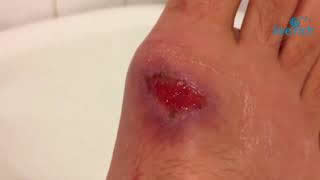 ----Aloe-Vera------LR
