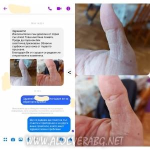 Спрей за спешна помощ с ферментирал гел Алое Вера, LR SOS Aloe Vera Emergency Spray, 150 мл